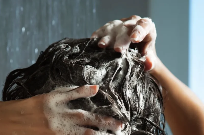 8 Best Scalp Treatments for Dandruff And Itchiness in 2026